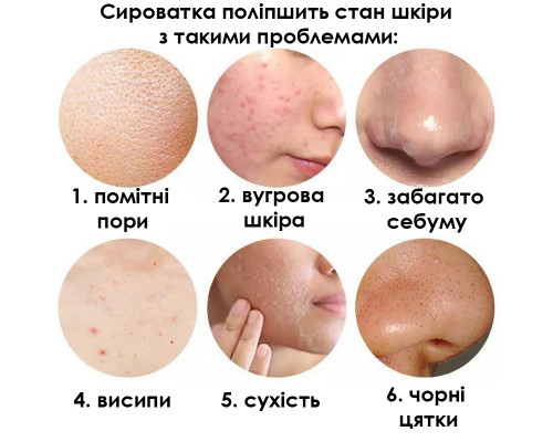 Сыворотка для лица SERSANLOVE Cactus Essence 30 мл с экстрактом кактуса